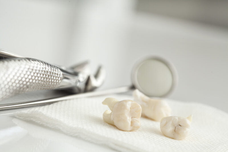Are you needing to schedule a wisdom teeth removal soon but unsure of whether or not it's the right time? Here's a guide on when to set your appointment.