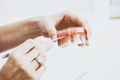how to choose dental implants