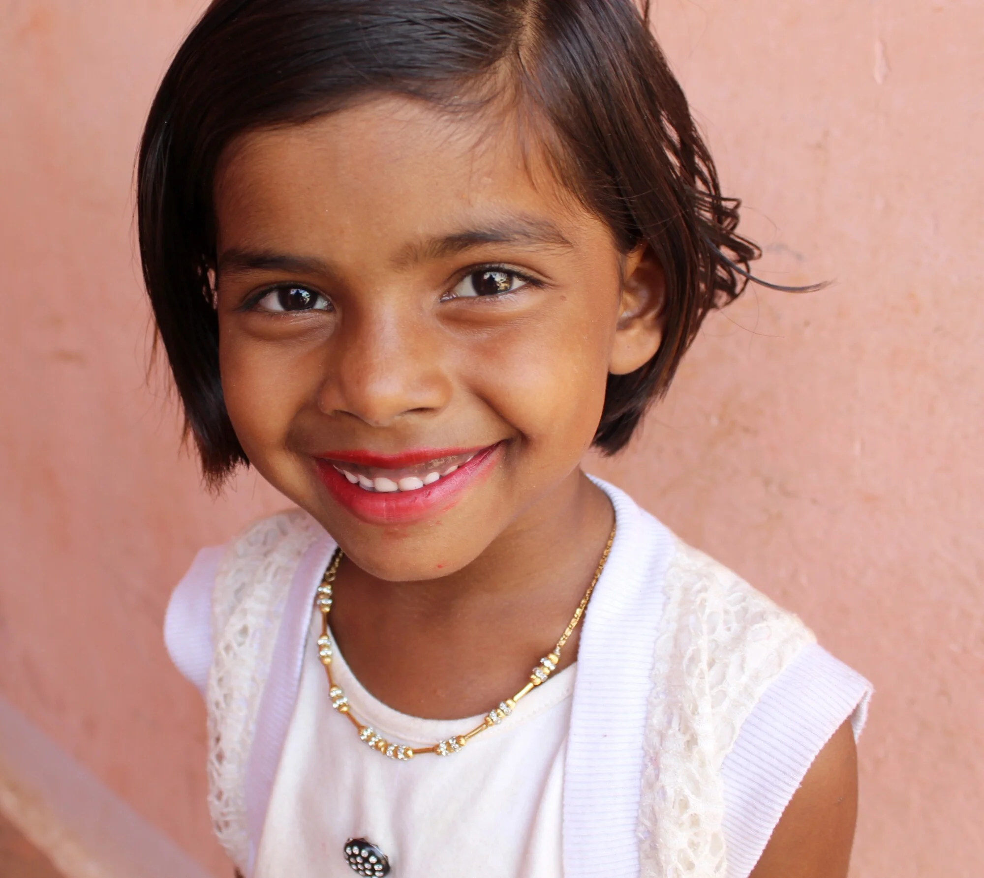 It's common for kids to have crooked teeth, though it should definitely not be ignored. Here are the benefits to having straight teeth.