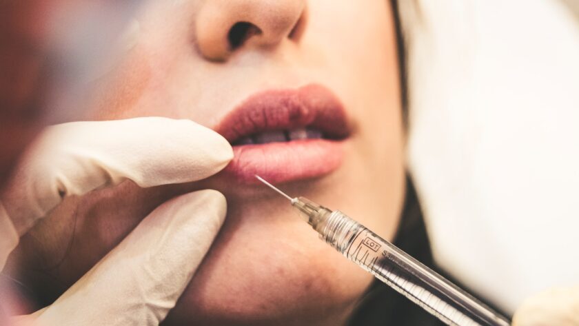 5 Reasons To Opt For Lip Injections In Vancouver