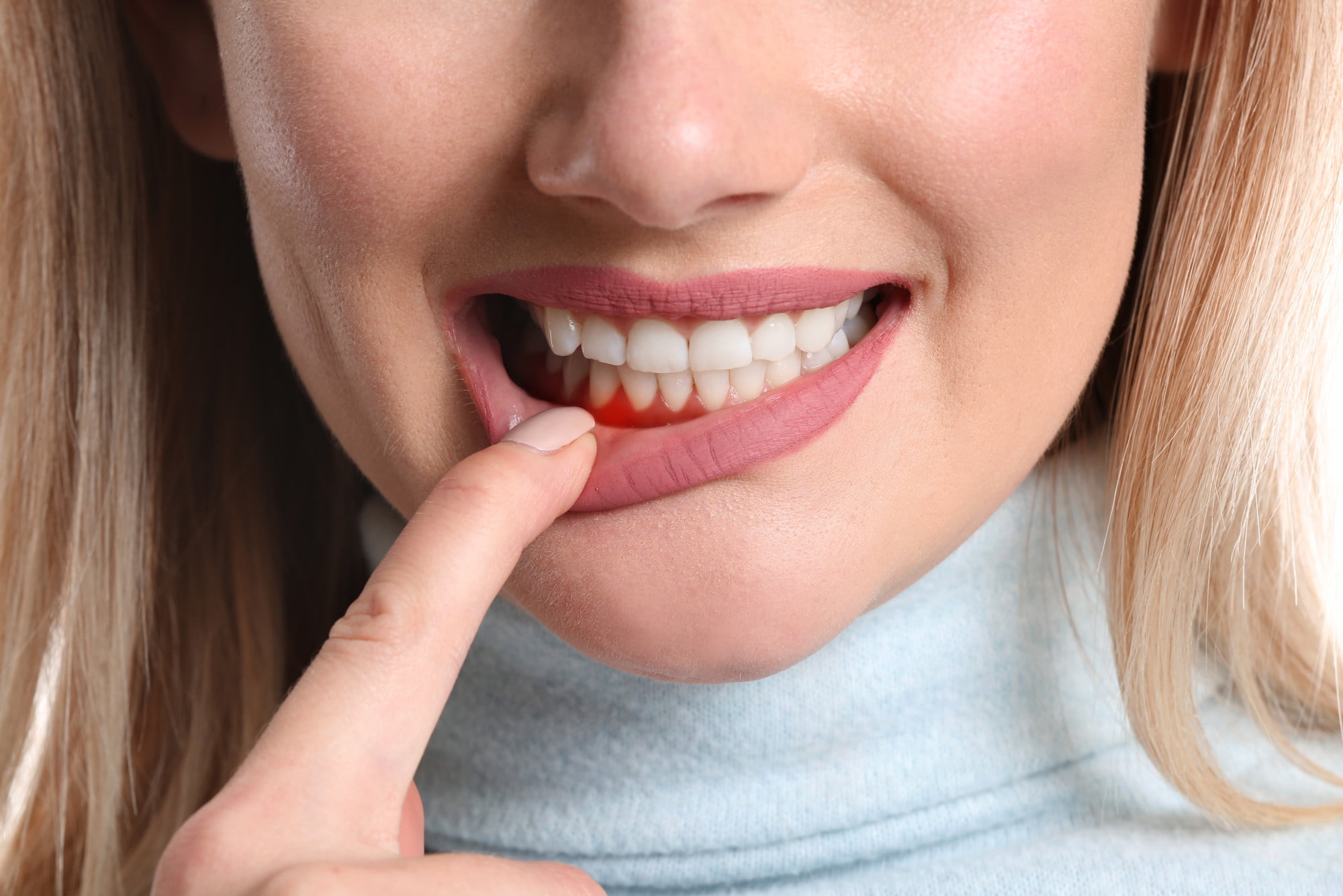 The problem of receding gums can sneak up on you. Explore this informative guide and learn about what causes gum recession, and what you can do to prevent it.