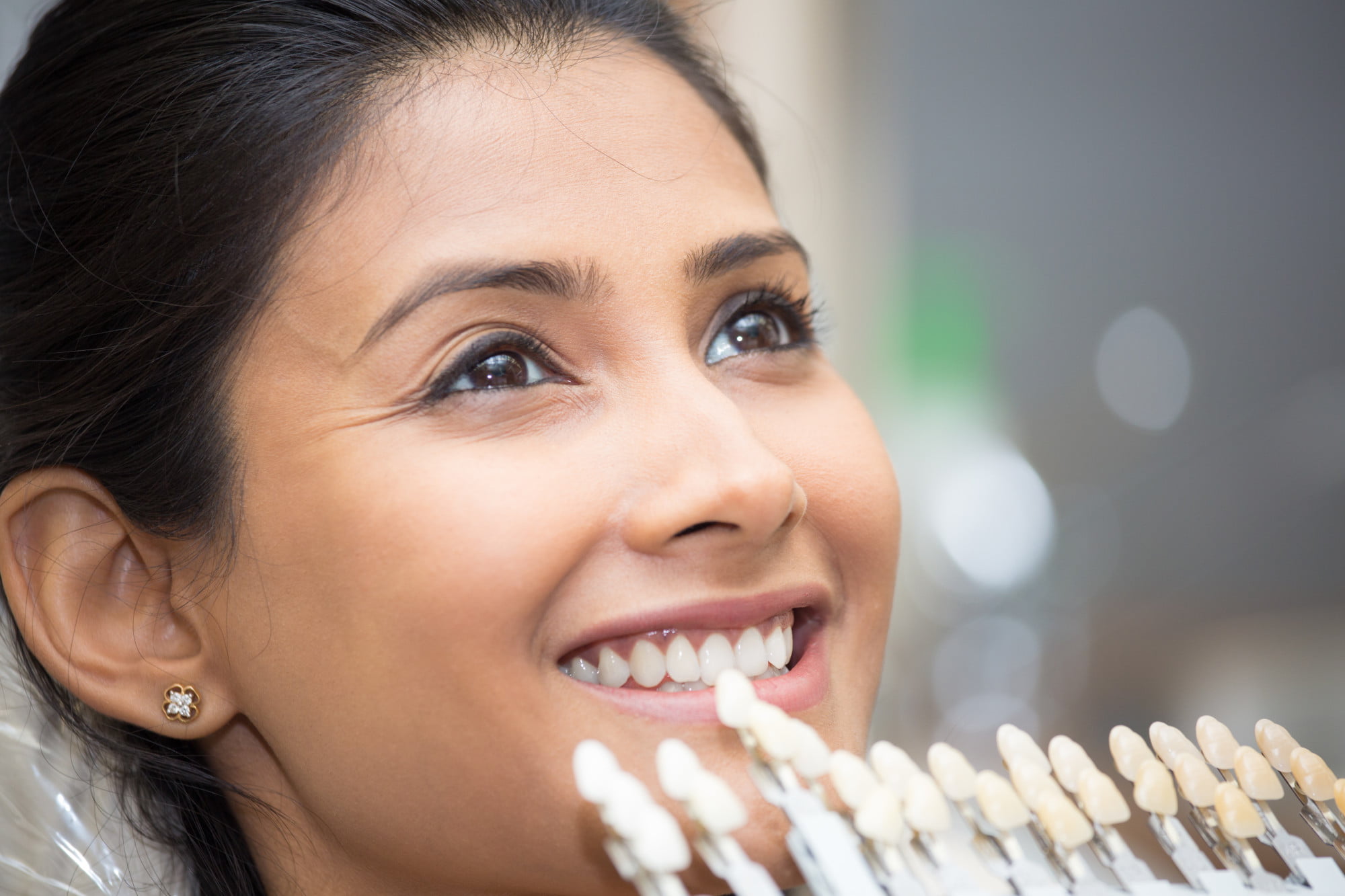 Want to improve your smile and confidence with veneers? Learn about the different types of veneers and their cost before making an appointment.