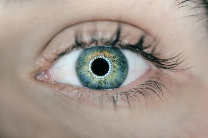 Points to Consider When Looking at Laser Eye Surgery