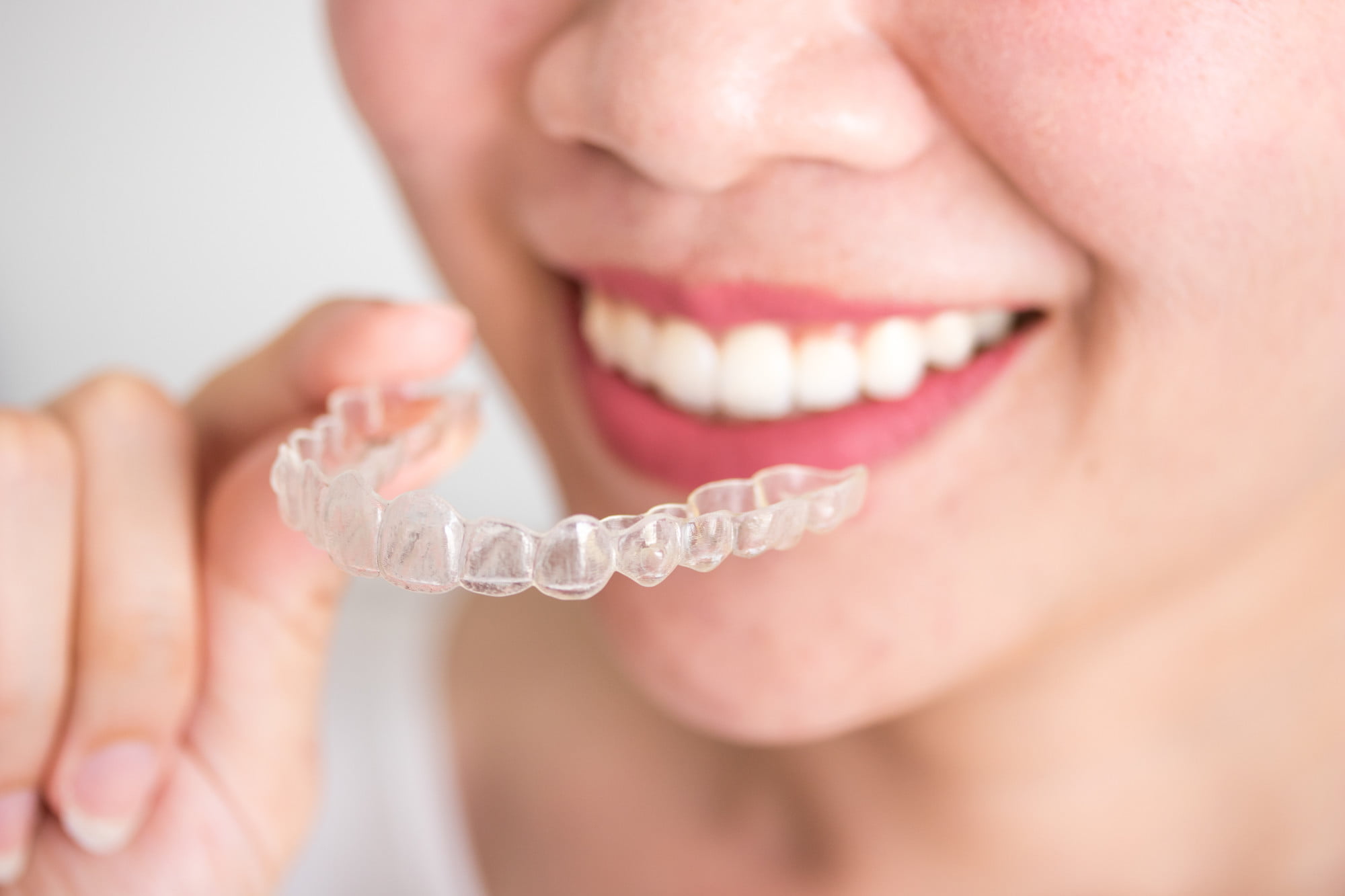 There are a ton of benefits that come with Invisalign treatment. Here's a quick look at five benefits of Invisalign that you should know about.
