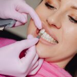 Veneers Prices in Australia: Everything You Need to Know About the Cost of Veneers In Australia