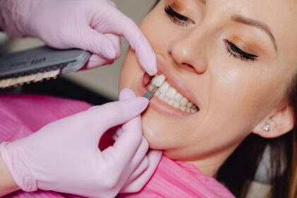 Veneers Prices in Australia: Everything You Need to Know About the Cost of Veneers In Australia
