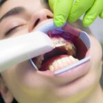 Gum Disease Treatment at Cloverdale Dental Clinic: Periodontics Solutions