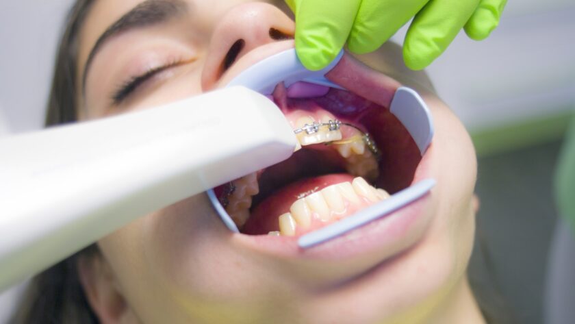 Gum Disease Treatment at Cloverdale Dental Clinic: Periodontics Solutions