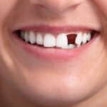 Are you tired of dealing with problems with your dental implants? Click here for three telltale signs that you need a dental implant repair.