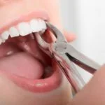 If you want a straighter smile, there are tons of options for tooth alignment. How long does the process typically take? Learn what to expect here.