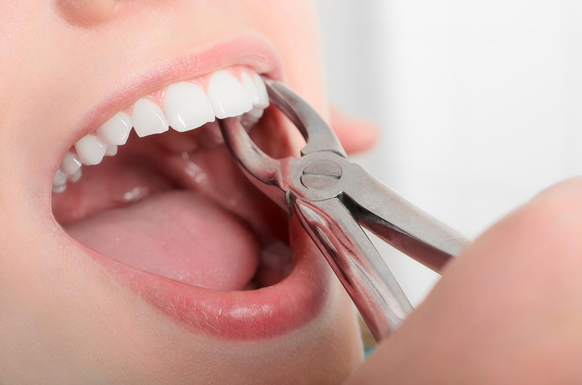 If you want a straighter smile, there are tons of options for tooth alignment. How long does the process typically take? Learn what to expect here.