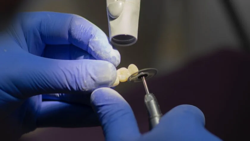 Understanding The Benefits Of Choosing Dental Implants Over Dentures