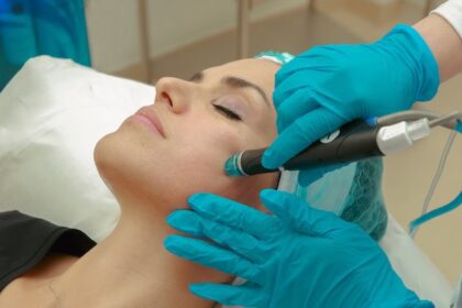 What Happens During Micro-Needling?