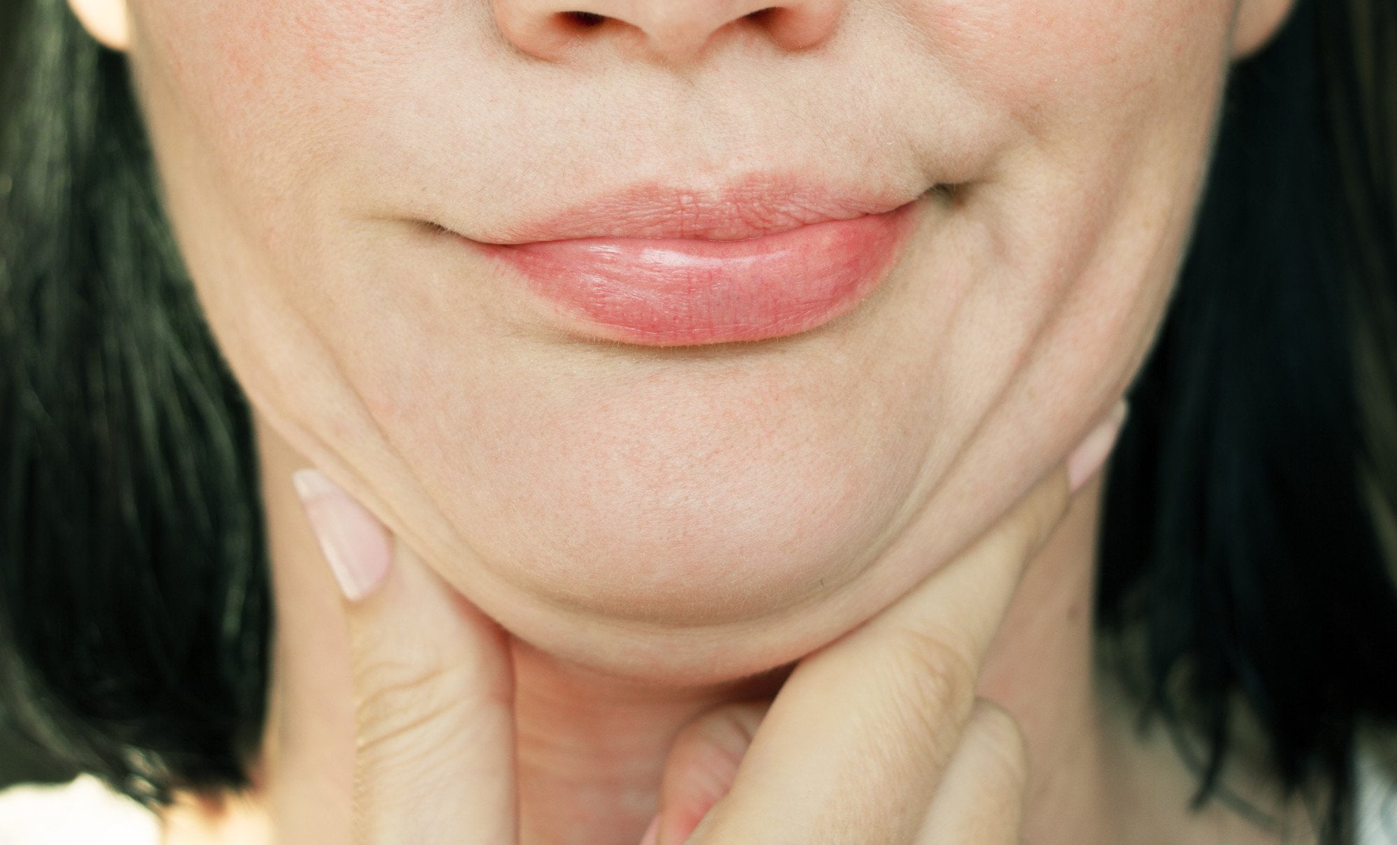Are you tired of struggling to get rid of your double chin? Click here for a patient's guide to cool sculpting for double chin reduction.