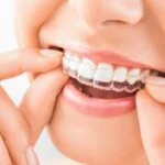 There are several things you need to know when it comes to comparing the cost of Invisalign vs braces. Learn more about these prices right here.