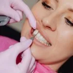 You're stopping yourself from getting the treatment because you're concerned about one thing: Do veneers damage your teeth? Let this guide ease your worries.