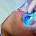 Teeth Whitening Cost: Strips Vs Cosmetic Dentist