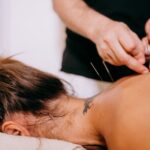 Boosting Immunity With Acupuncture