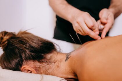 Boosting Immunity With Acupuncture